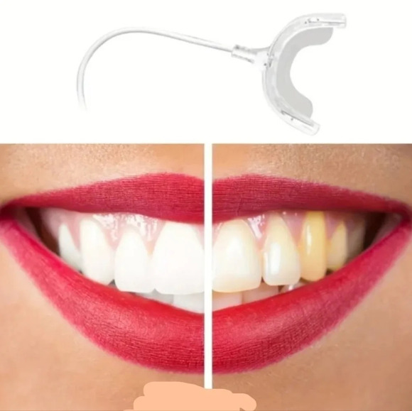 LED teeth whitening cold wave lighted tray, unisex - Picture 4 of 9